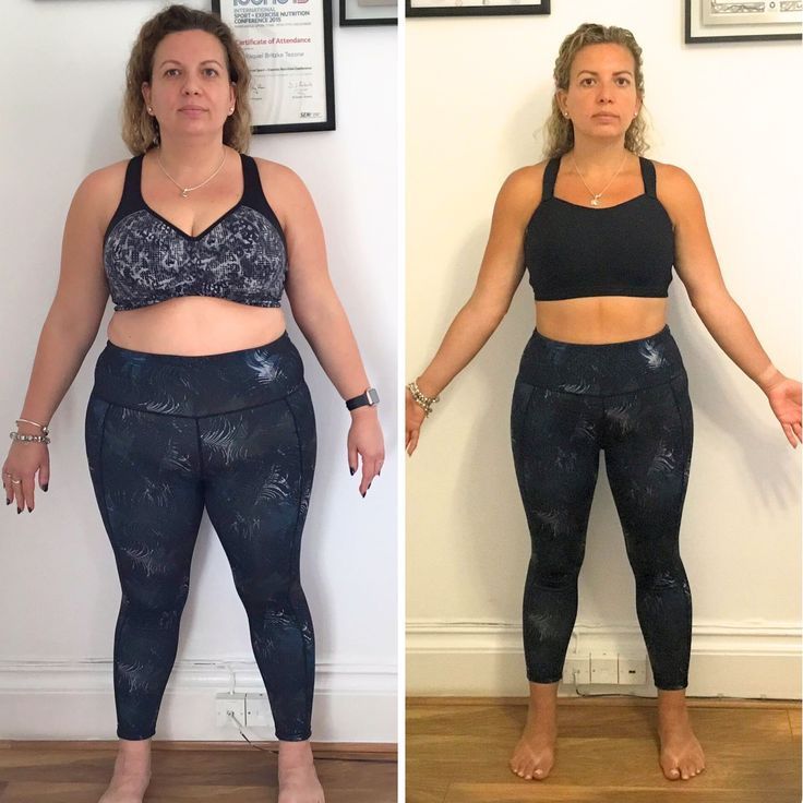 Antes e depois de Amanda