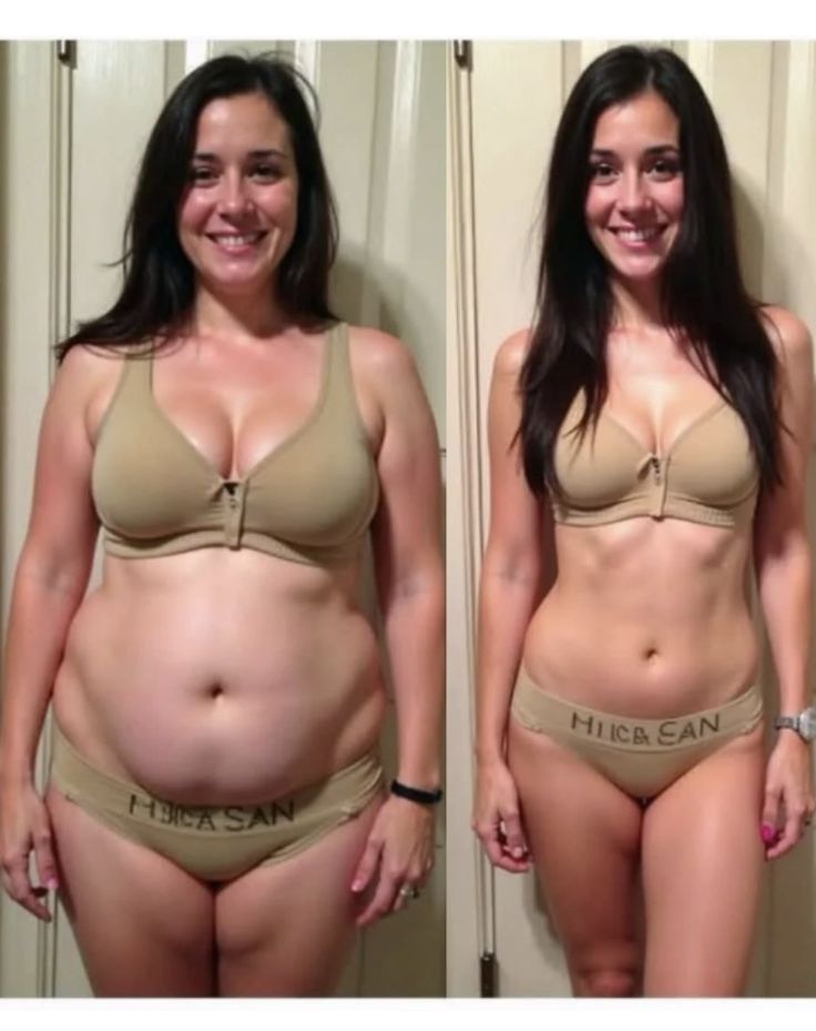 Antes e depois de Patrícia