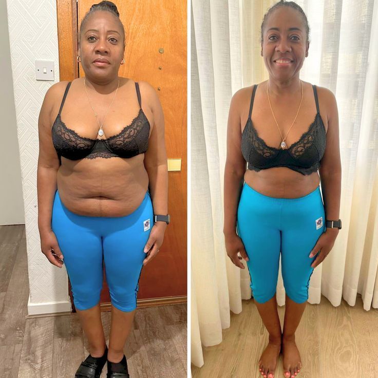 Antes e depois de Patrícia